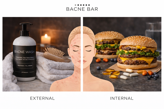 external and internal acne triggers